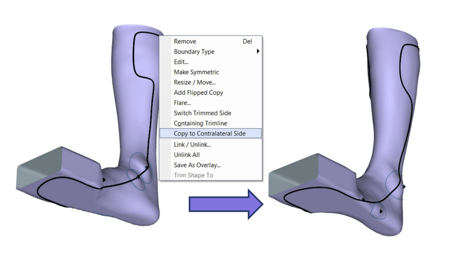 Copy Trimline to Contralateral Side